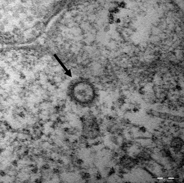 코로나19 바이러스의 고해상 전자현미경 사진. (사진=질병관리본부)