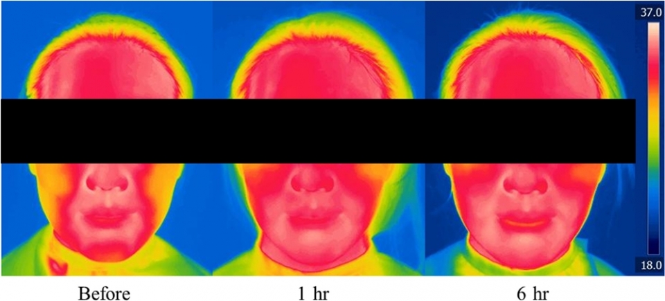 아모레퍼시픽은 하루 동안 마스크를 쓴 시간에 따른 피부 변화를 연구한 논문(Effect of face mask on skin characteristics changes during the COVID‐19 pandemic)이 지난 20일자로 SCI급 국제 학술지인 ‘스킨 리서치 앤드 테크놀로지(Skin Research & Technology)’ 온라인판에 게재됐다고 25일 밝혔다. (사진=아모레퍼시픽)